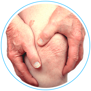 Fisioterapia Para Artrosis
